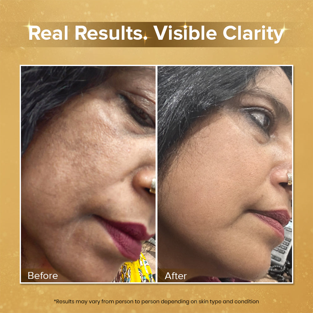 Soundaryam Kumkumadi Serum Saffron & Wheat Germ Oil