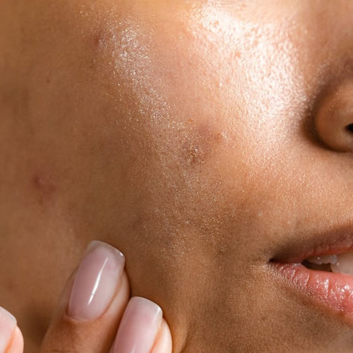Dry & Itchy Skin