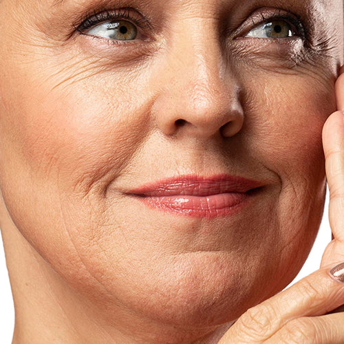 Fine Lines & Wrinkles