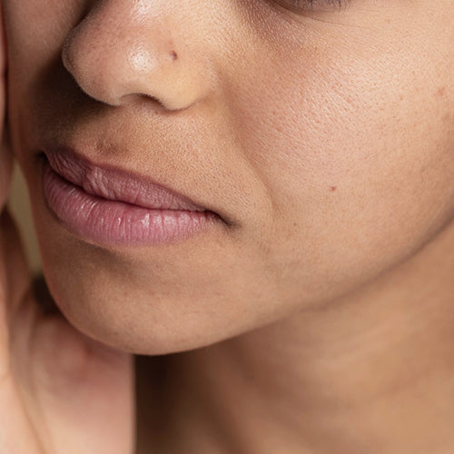 Pigmentation & Dullness