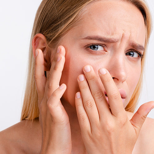 Sensitive Skin