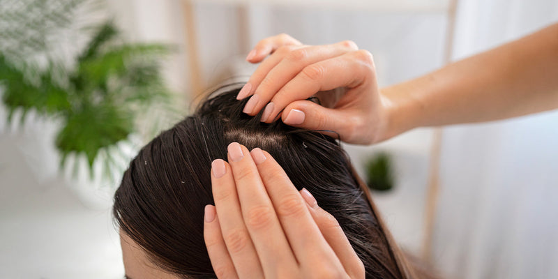 How Ayurveda Helps Control Dandruff: 3 Easy At-Home Remedies