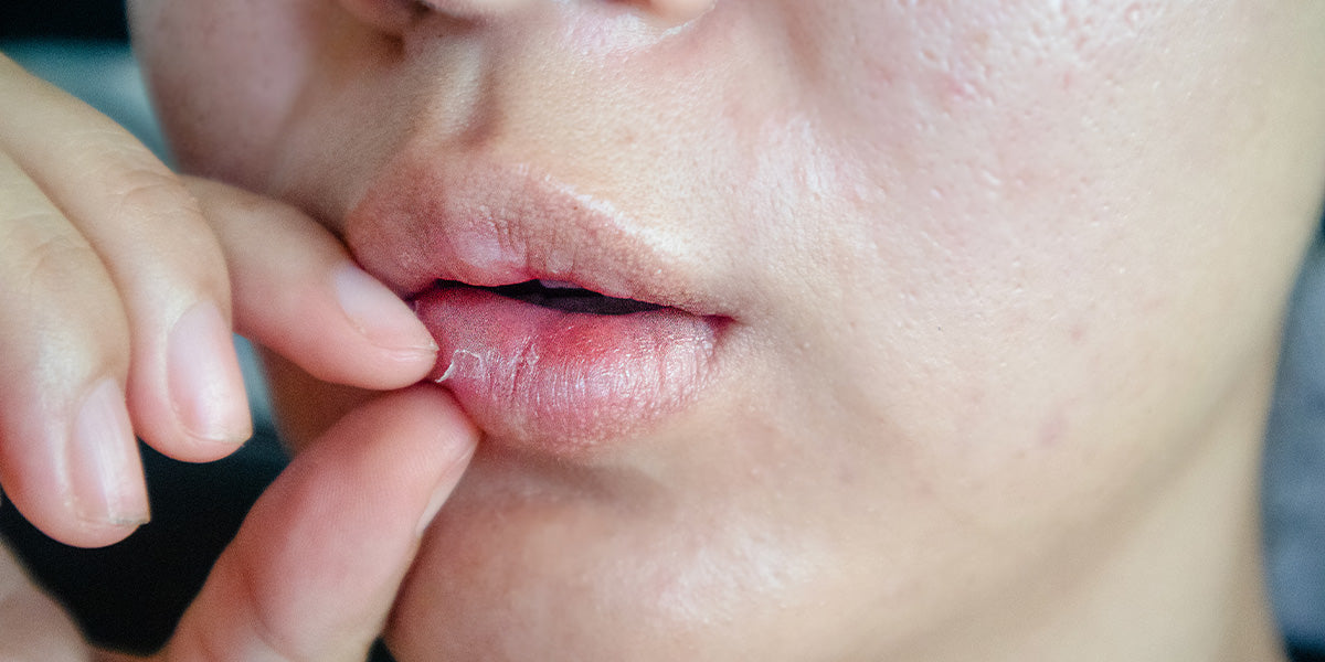 Why Your Lips Need Extra Care When Seasons Change