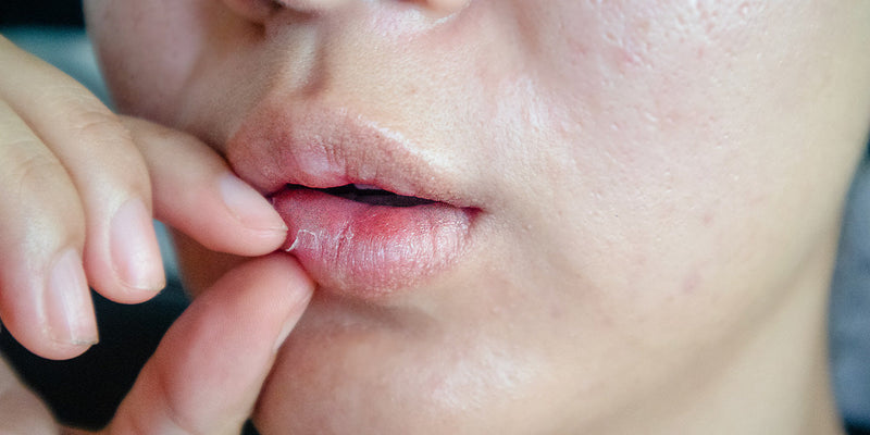 Why Your Lips Need Extra Care When Seasons Change