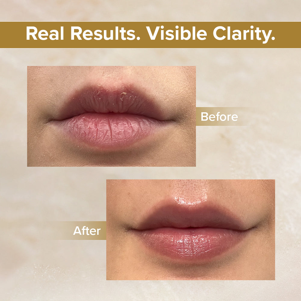 Intense Relief Lip Balm Mandarin Orange & Olive