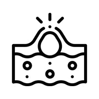 Acne  <br/>Relief
