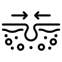 Minimizes </br>Pores