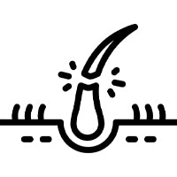Repairs</br> Damage